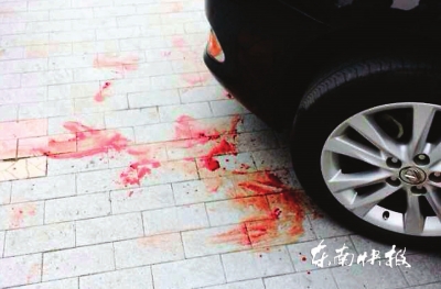 男子一头撞上小车,小车车头前满是血迹